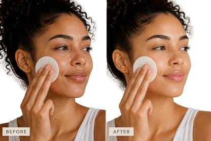 Toner Pads Zero Pore Pad 2.0